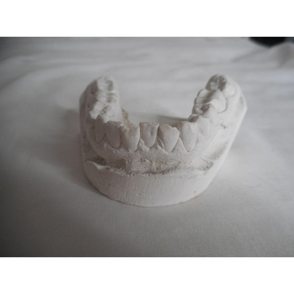 Vintage Cast Dental Teeth Mold  Tooth Castings Medical Oddity #1